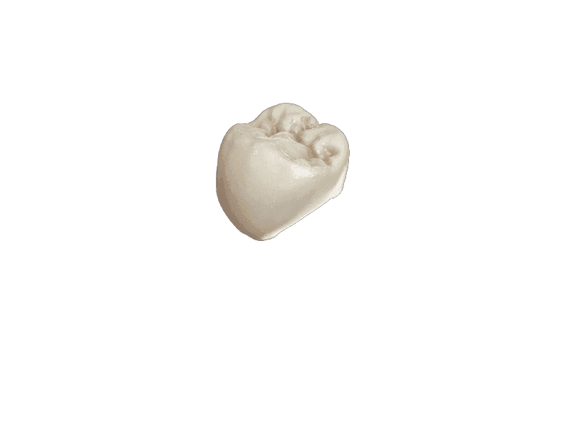 Crowns, Bridges & Restorations