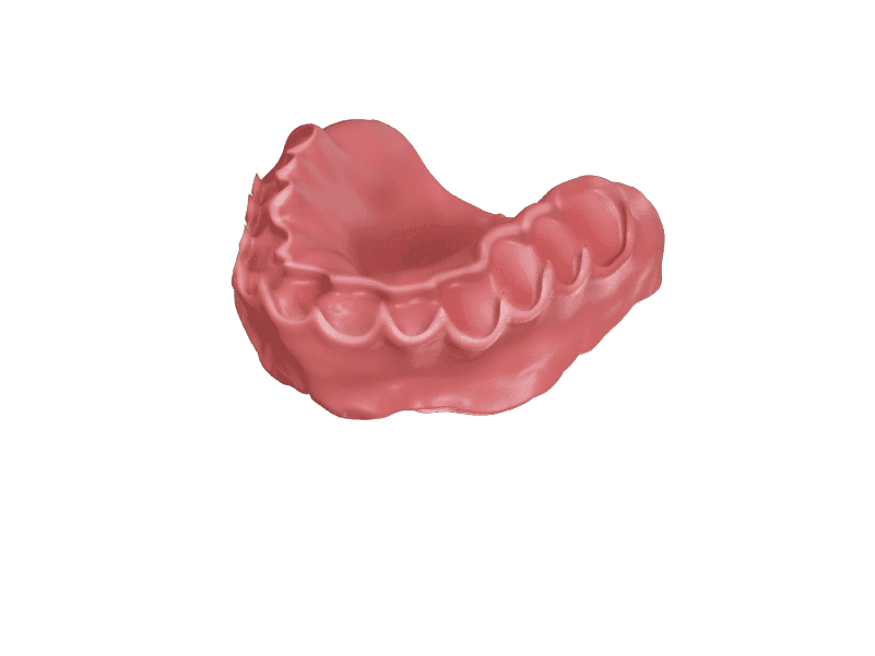 Flexible Partial Dentures