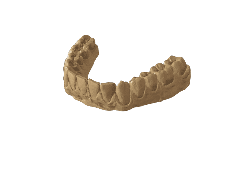 Dental Models